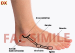 Mappa laterale